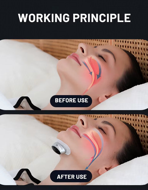 Load image into Gallery viewer, SmartSnore™ 5-Pair EMS Anti-Snoring Device – Breathe Easy, Sleep Deep
